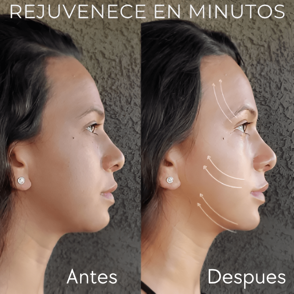 Rejuvenece en Minutos                     Maquina + Gel + Envio Gratis